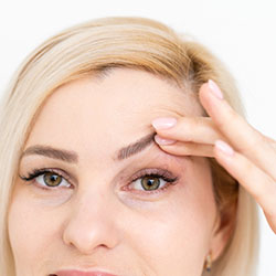 Is Upper Eyelid Surgery Right for Me?