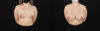Breast Augmentation case #6402 slider thumbnail