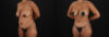 Tummy Tuck case #7619 slider thumbnail