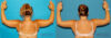 Liposuction case #5893 slider thumbnail
