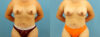 Fat Grafting to the Breast case #256201 slider thumbnail
