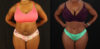 Tummy Tuck case #7282 slider thumbnail
