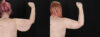Arm Lift case #256569 slider thumbnail