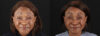 Botox® & Other Neuromodulators case #262991 slider thumbnail